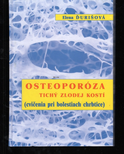Osteoporóza - Tichý zlodej kostí