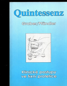 Klinické postupy ve fixní protetice